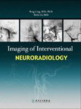 Imaging of Interventional Neuroradiology