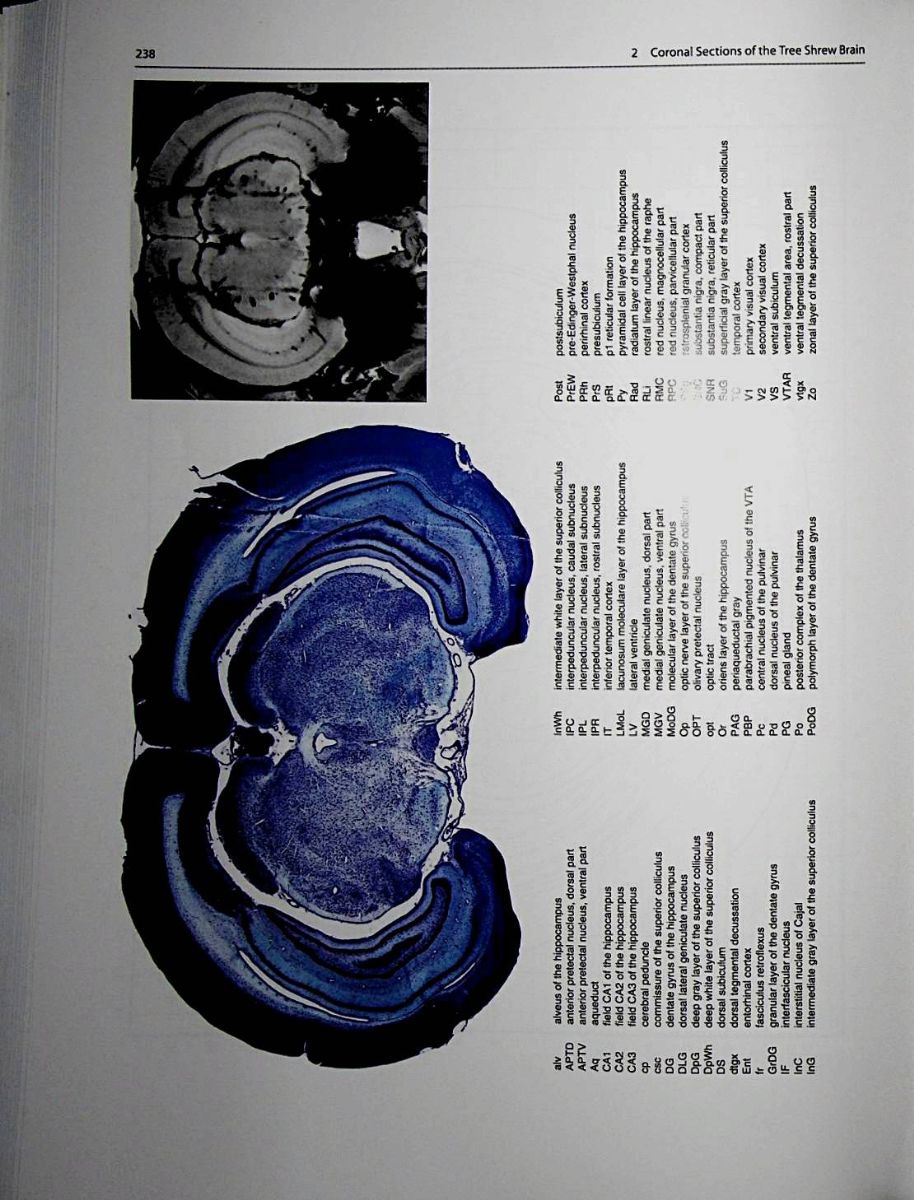 The Tree shrew (Tupaia Belangeri Chinensis) Brain in Stereotaxic ...